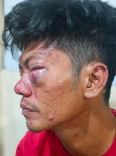Oknum Polisi Selayar Ngamuk Bak Preman Hajar Pria sampai Wajah Hancur dan Hidung Bengkak Oknum Polisi Selayar Ngamuk Bak Preman Hajar Pria sampai Wajah Hancur dan Hidung Bengkak