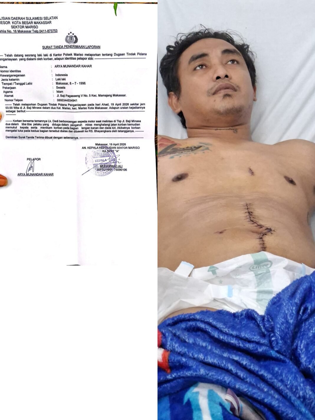 Hukum Mandul di Polsek Mariso! Palaku Penikam Berkeliaran Bebas Depan Polsek, Resmob Diduga ‘Tutup Mata’, Hukum Mandul di Polsek Mariso! Palaku Penikam Berkeliaran Bebas Depan Polsek, Resmob Diduga ‘Tutup Mata’,