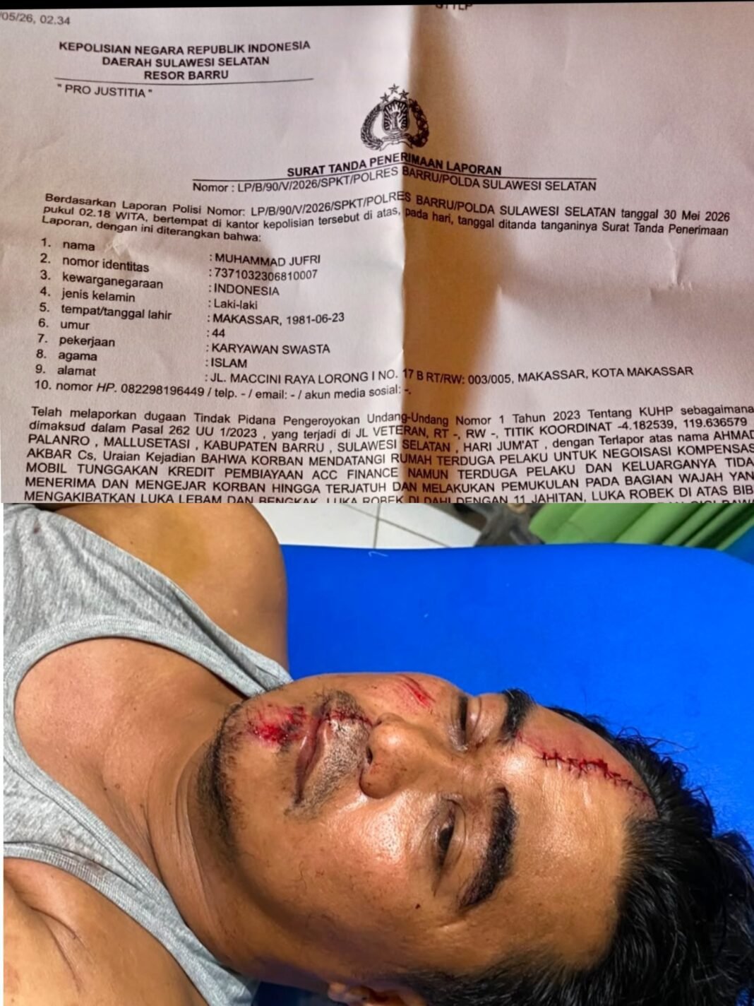 Pelaku pengeroyokan kebal Hukum Kinerja kepolisian Barru di pertanyakan Pelaku pengeroyokan kebal Hukum Kinerja kepolisian Barru di pertanyakan