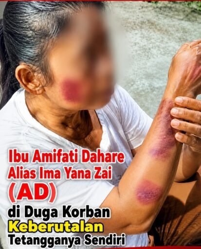 Diduga Kebal Hukum, Preman di Ulugawo Nias Hajar Ibu Rumah Tangga Hingga Pingsan dan Tantang Polisi Diduga Kebal Hukum, Preman di Ulugawo Nias Hajar Ibu Rumah Tangga Hingga Pingsan dan Tantang Polisi